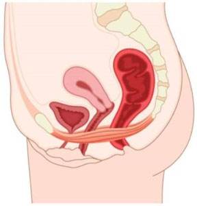 Perineologia - Dott. Carmelo GEREMIA - Specialista in Gastroenterologia